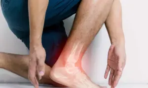 Homme souffrant d'une entorse à la cheville, avec une radiographie montrant l'articulation douloureuse. L'argile verte pourrait soulager cette entorse.