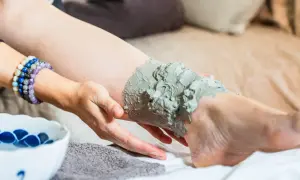 Application d'un cataplasme d'argile verte sur le genou pour un soin apaisant.