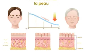 Le vieillissement de la peau montre une baisse du collagène avec l'âge. Le manque de collagène symptômes incluent rides et perte d'élasticité.