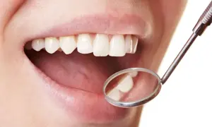 Un sourire éclatant grâce à l'huile de coco pour des dents blanches. Un miroir dentaire reflète des dents saines et lumineuses.
