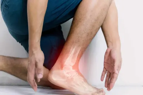 Homme souffrant d'une entorse à la cheville, avec une radiographie montrant l'articulation douloureuse. L'argile verte pourrait soulager cette entorse.