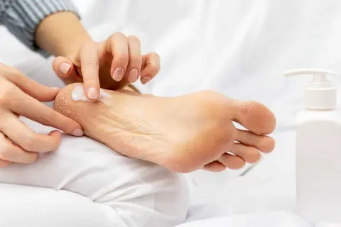 Application de crème hydratante sur un pied sec. Un tuto pieds au sec pour des pieds doux et sains.