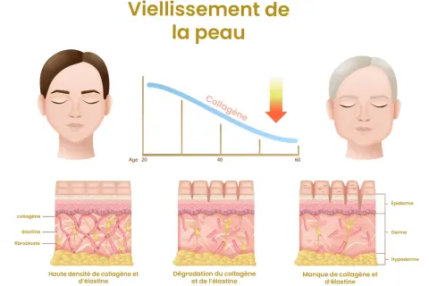 Le vieillissement de la peau montre une baisse du collagène avec l'âge. Le manque de collagène symptômes incluent rides et perte d'élasticité.