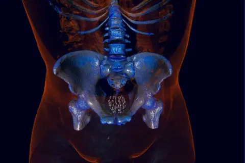 Imagerie 3D du bassin masculin, montrant la colonne vertébrale et les os pelviens. Utile pour comprendre les prostate symptômes et traitements naturels.
