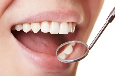Un sourire éclatant grâce à l'huile de coco pour des dents blanches. Un miroir dentaire reflète des dents saines et lumineuses.