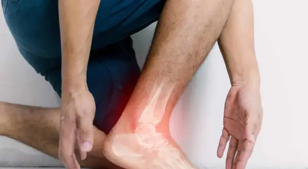 Homme souffrant d'une entorse à la cheville, avec une radiographie montrant l'articulation douloureuse. L'argile verte pourrait soulager cette entorse.