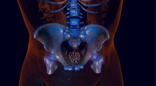 Imagerie 3D du bassin masculin, montrant la colonne vertébrale et les os pelviens. Utile pour comprendre les prostate symptômes et traitements naturels.