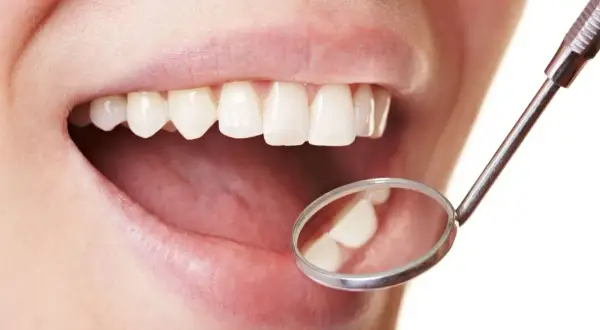 Un sourire éclatant grâce à l'huile de coco pour des dents blanches. Un miroir dentaire reflète des dents saines et lumineuses.