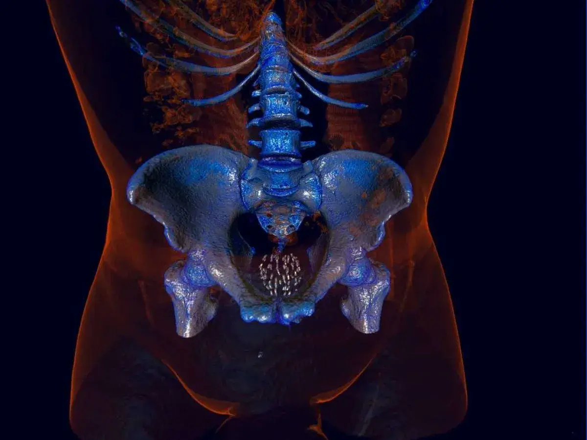 Imagerie 3D du bassin masculin, montrant la colonne vertébrale et les os pelviens. Utile pour comprendre les prostate symptômes et traitements naturels.