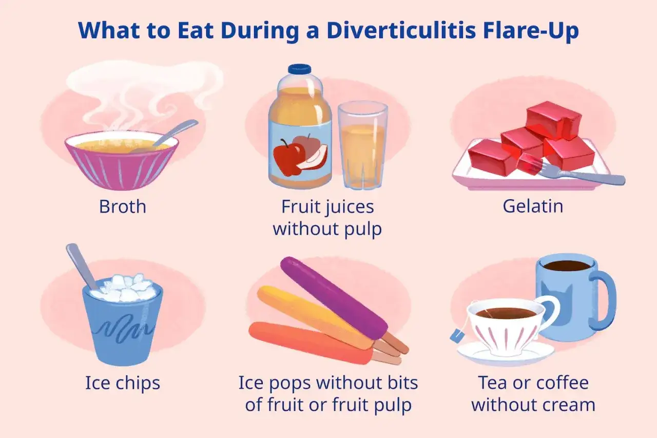 En cas de diverticulite, privil&eacute;giez bouillons, jus sans pulpe, g&eacute;latine, gla&ccedil;ons, glaces sans fruits et th&eacute;/caf&eacute; sans cr&egrave;me. &Eacute;vitez les aliments irritants.