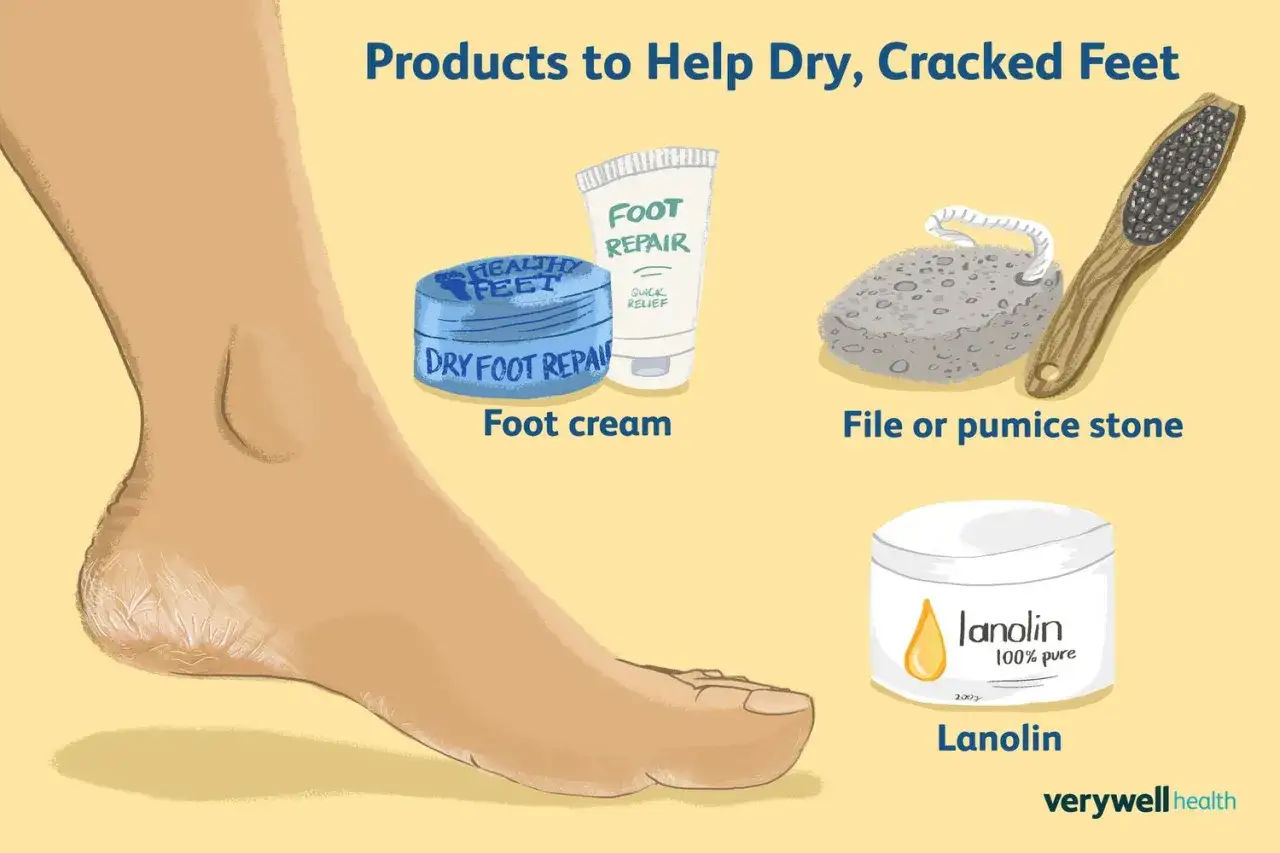 Tuto pieds au sec : une illustration montre un pied sec et craquel&eacute;, avec des produits pour le soin : cr&egrave;me, pierre ponce et lanoline.