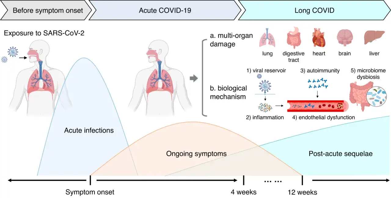 Sch&eacute;ma du COVID long : exposition au SARS-CoV-2, infections aigu&euml;s, sympt&ocirc;mes persistants, s&eacute;quelles post-aigu&euml;s. M&eacute;canismes : r&eacute;servoir viral, inflammation, auto-immunit&eacute;, dysfonctionnement endoth&eacute;lial, dysbiose du microbiote. Le traitement du covid l...