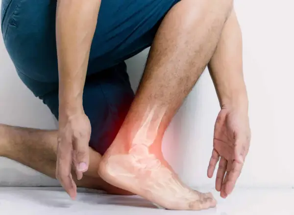 Homme souffrant d'une entorse à la cheville, avec une radiographie montrant l'articulation douloureuse. L'argile verte pourrait soulager cette entorse.