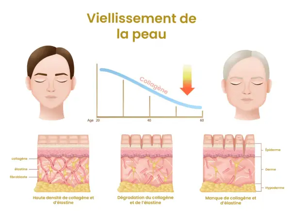 Le vieillissement de la peau montre une baisse du collagène avec l'âge. Le manque de collagène symptômes incluent rides et perte d'élasticité.