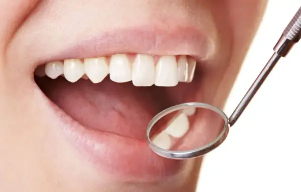 Un sourire éclatant grâce à l'huile de coco pour des dents blanches. Un miroir dentaire reflète des dents saines et lumineuses.